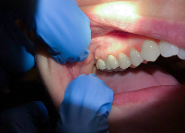 Best Broken Tooth Emergency  in Sabetha, KS
