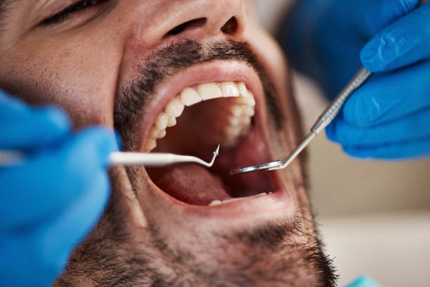 Best Cracked Tooth Emergency Dentist  in Sabetha, KS